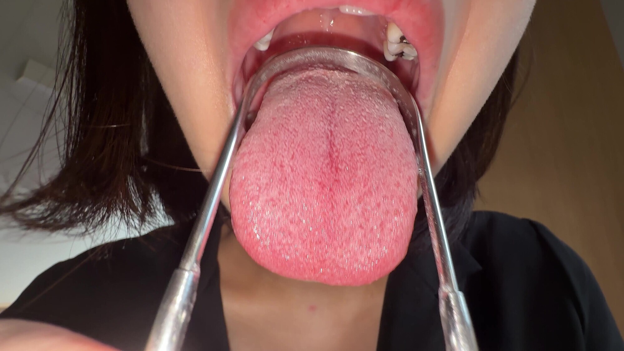 【個人撮影】湊波流の舌ブラシで「汚舌苔」採取！