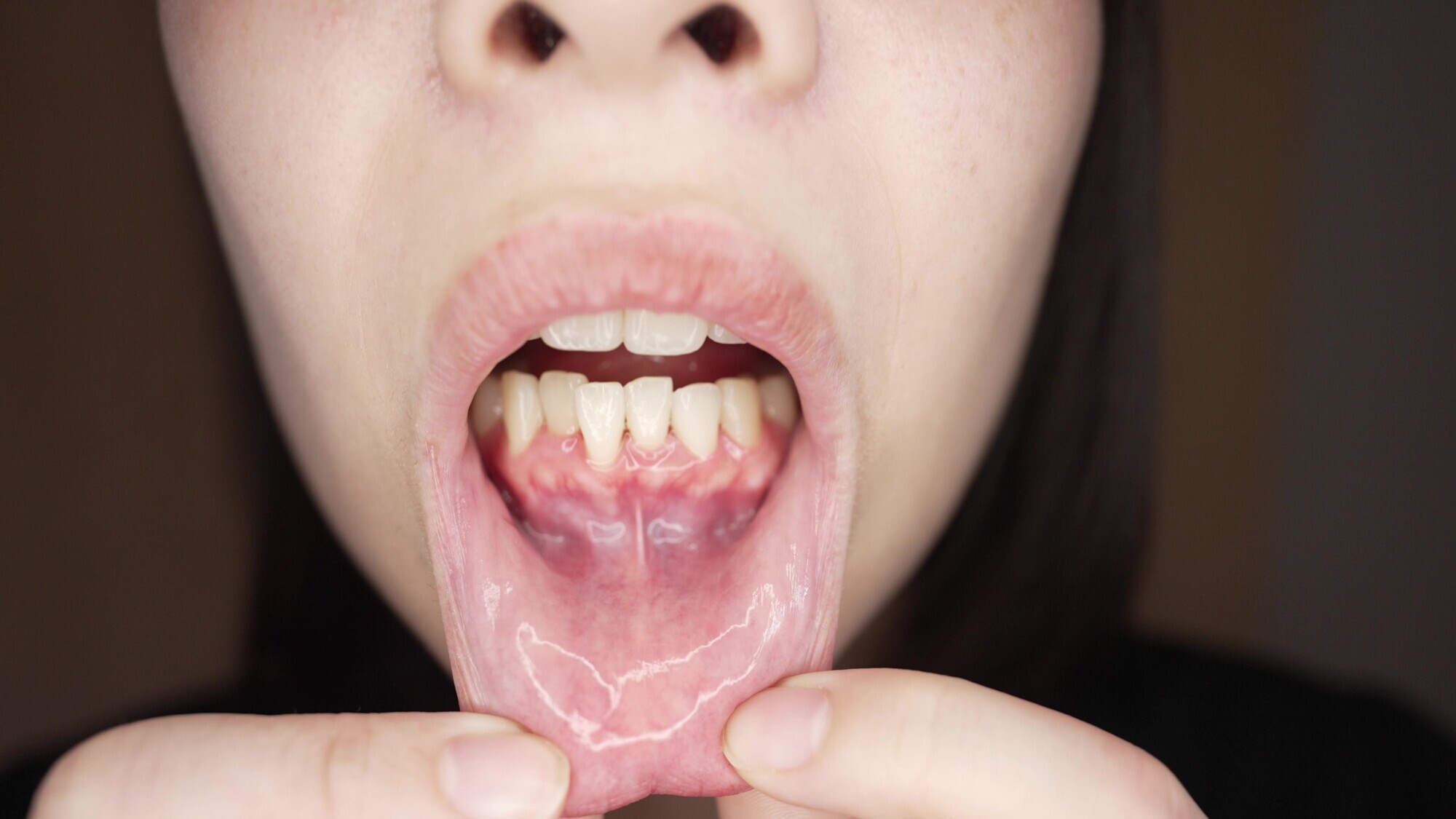 【個人撮影】湊波流の変態男の歯＆ベロ 臭いチェック！