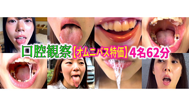 【特価】口腔観察 VOL.4 4名62分お買い得セット