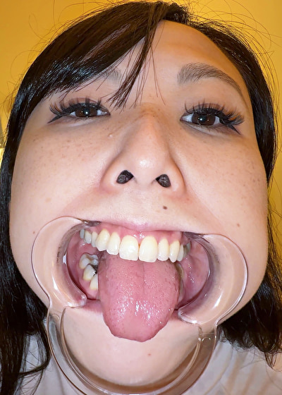 【個人撮影】横山夏希の喉チンコ触り＆肉厚舌を開口器で観察