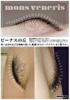 ビーナスの丘