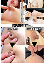 いびつな乳首