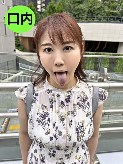 街角口内 11